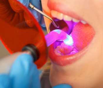 Gum Disease Prevention Near San Francisco dentist