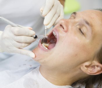 Gum Disease Treatment from San Francisco dentist