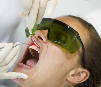 Periodontitis Treatment from San Francisco dentist